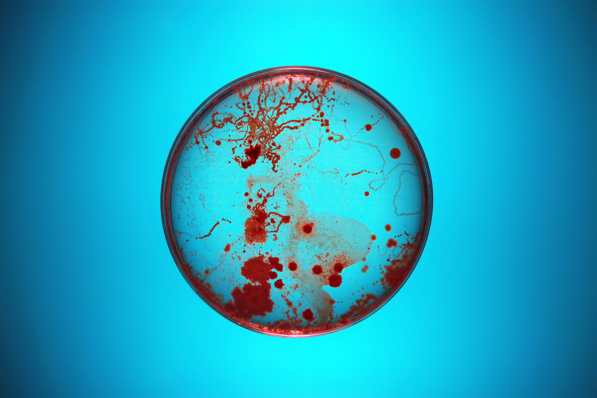 What investors need to know about antimicrobial resistance